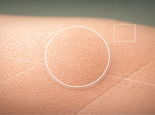 AI Skin Analysis API