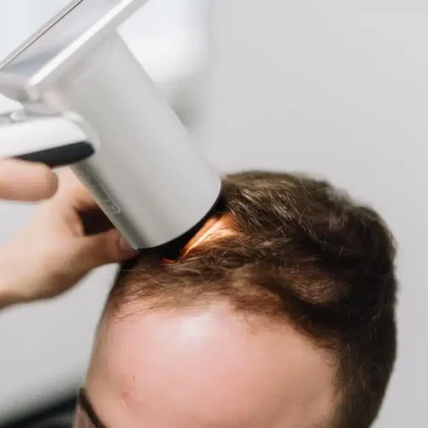 AI Hair Analysis API